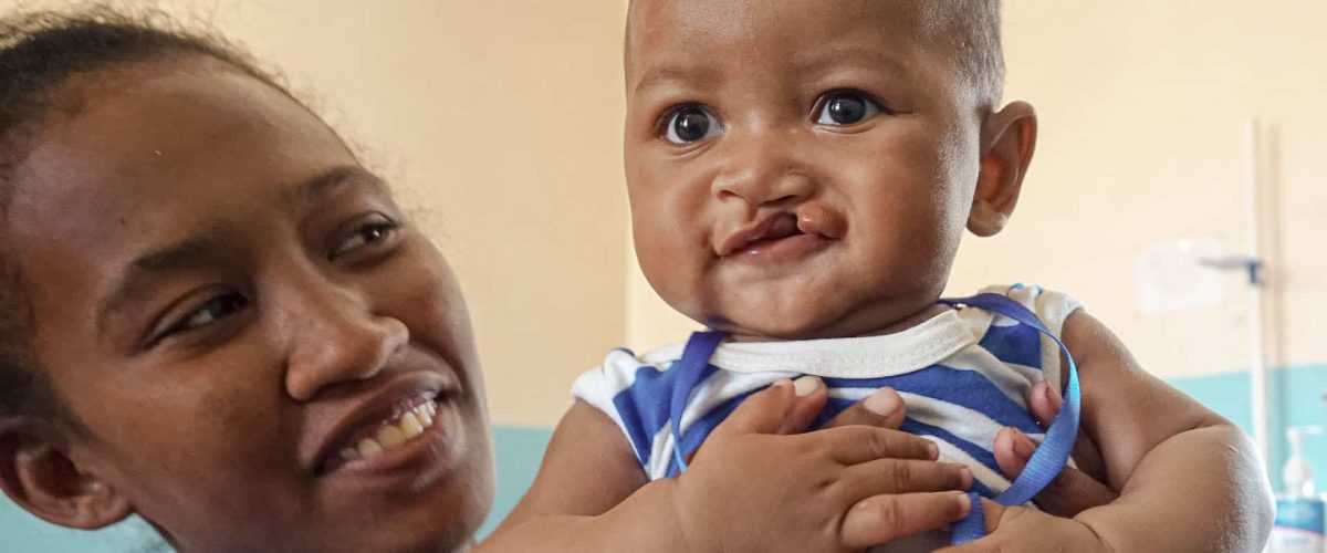 Sygeplejersken fra Mercy Ships med lille Osman, der nu kan blive opereret på hospitalsskibet Africa Mercy-web